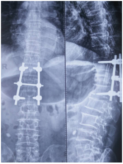 1533114057265506.jpg 1533113998(1).jpg